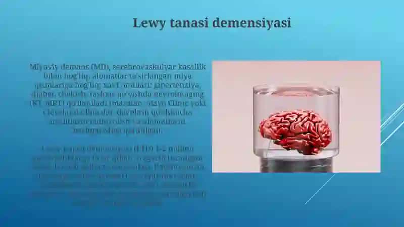 Turli etiologiyali demensiya 3