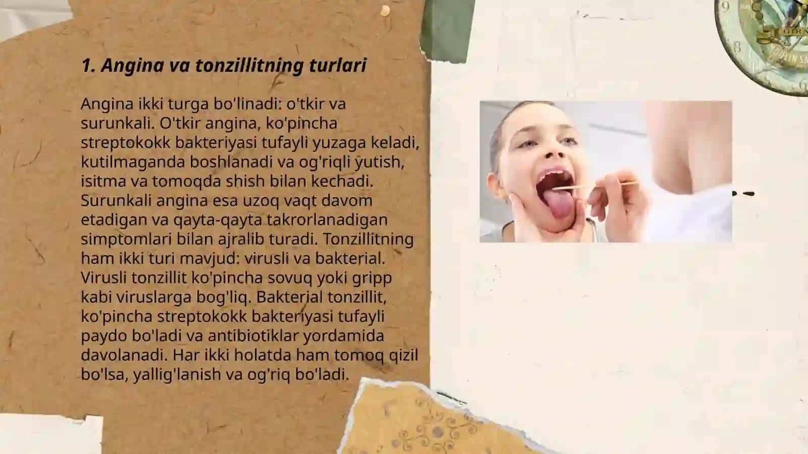 Tonzilit 3