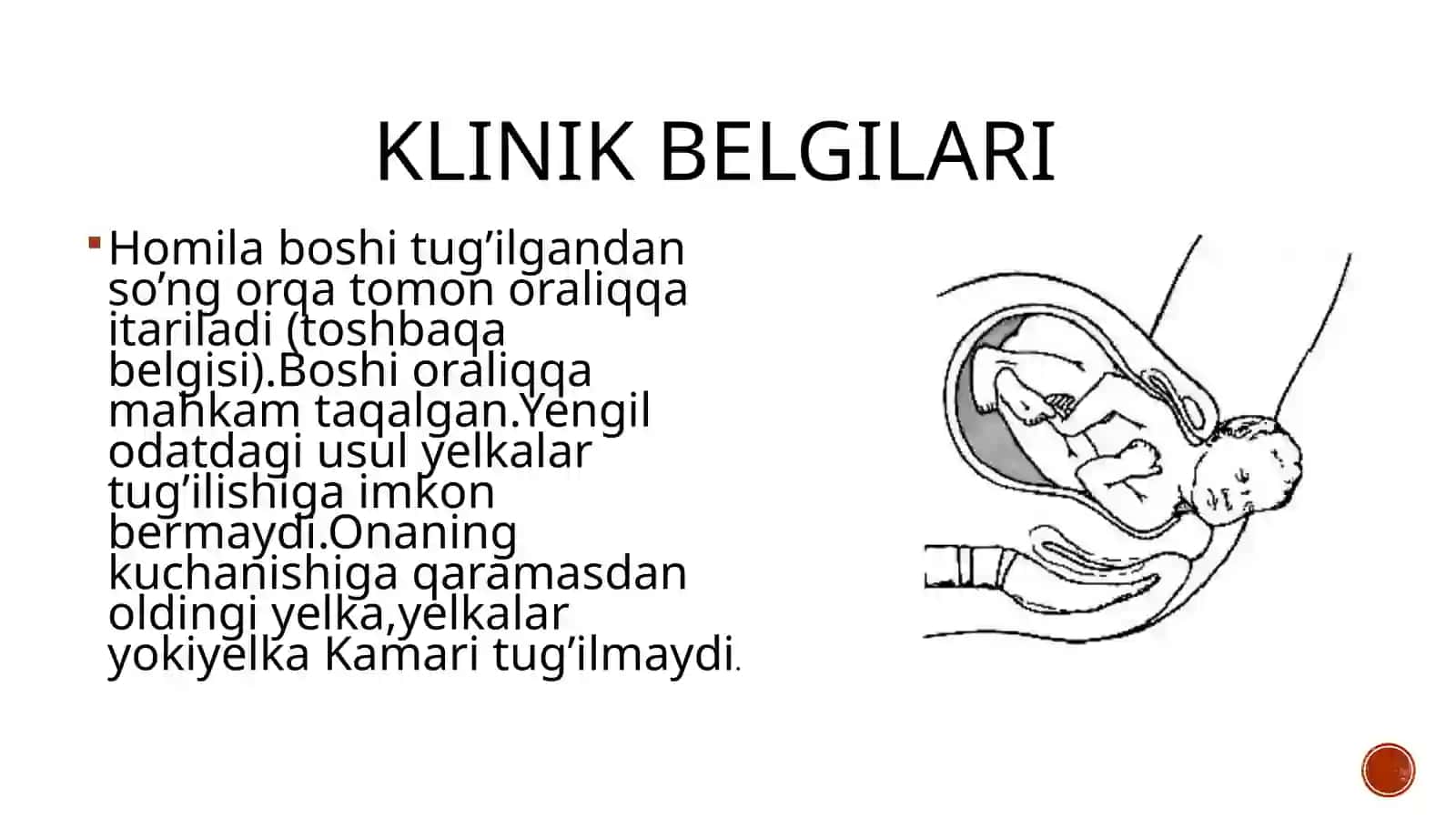 Yelkadistotsiyasi 3
