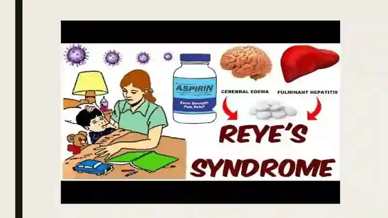 Reysindromi 3