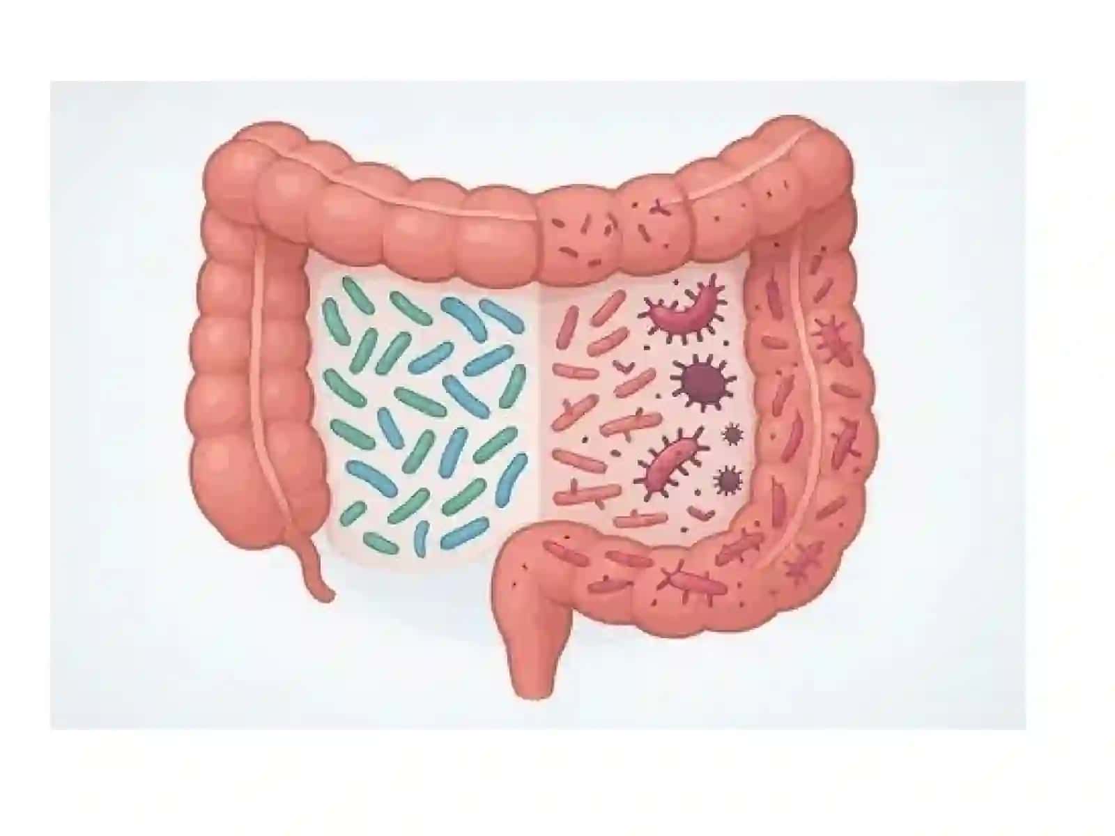 Mikrobiologiya va Immunobiologiya: Disbakterioz va tashhisi 3