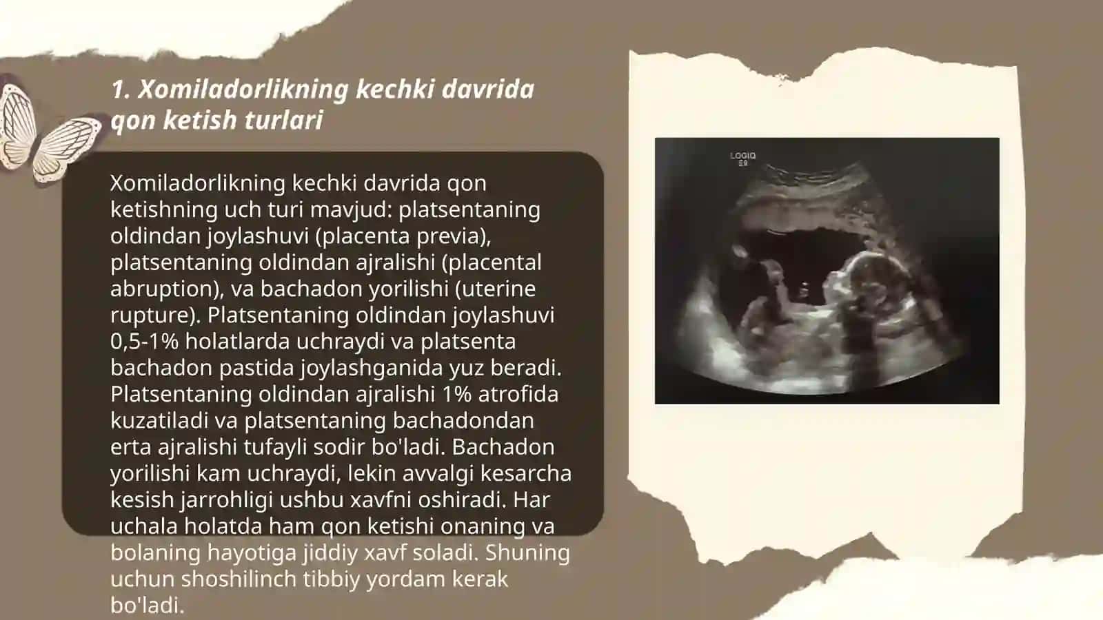 Xomiladorlikning kechki davrida qon ketish turlari 3