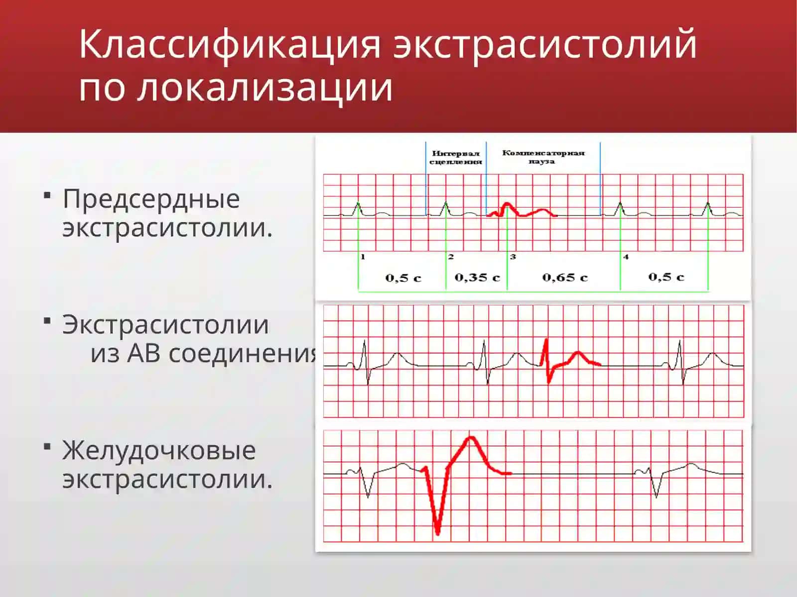 Ekstrasistoliya 3