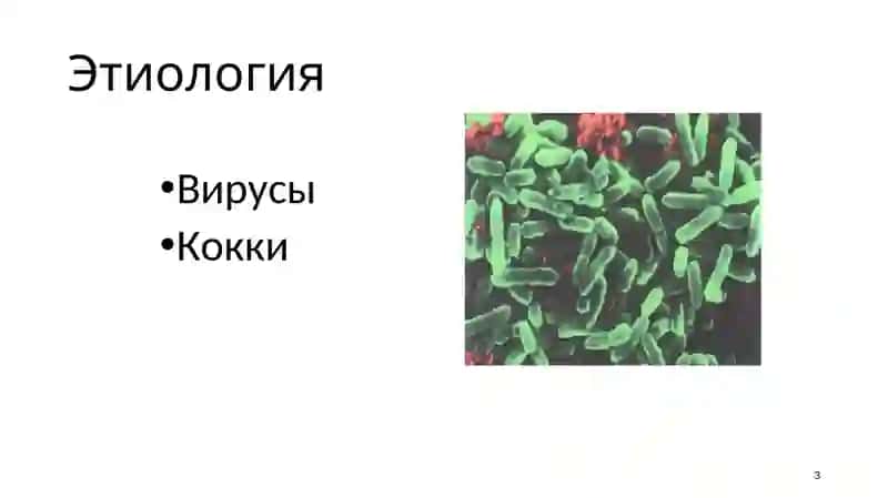 Острянка 3