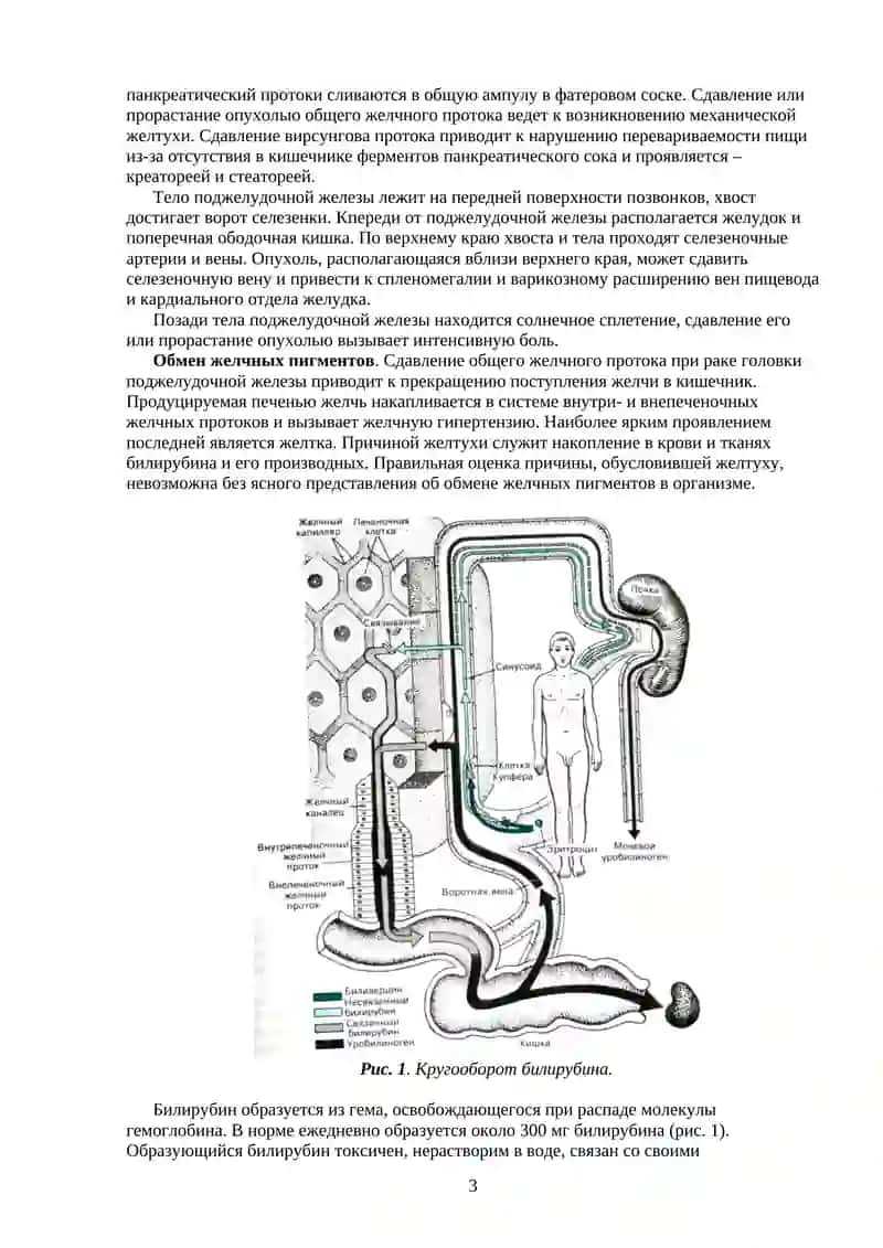 Рак поджелудочной железы 3