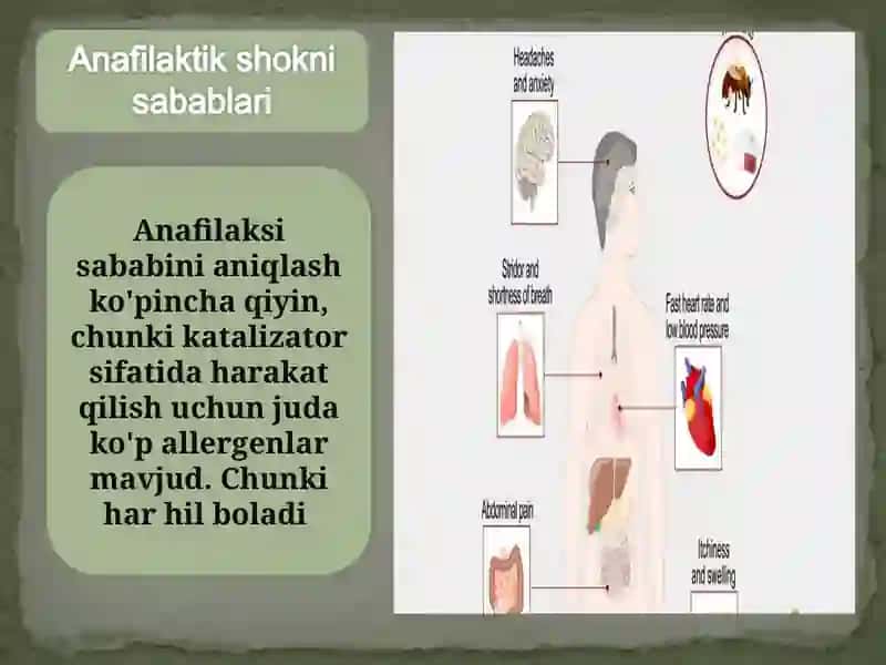 Anafilaktik shok 3