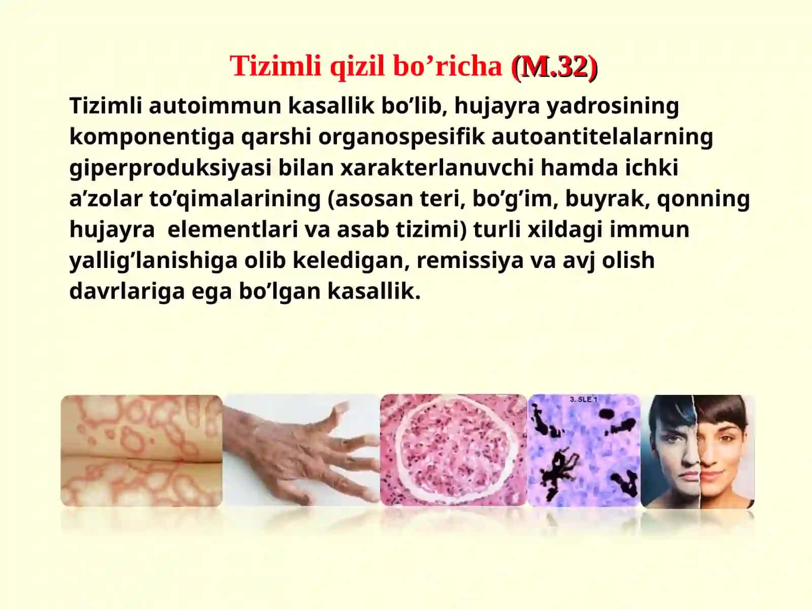TIZIMLI QIZIL BO’RICHA BIRIKTIRUVCHI TO’QIMANING TIZIMLI KASALLIKLARI 3