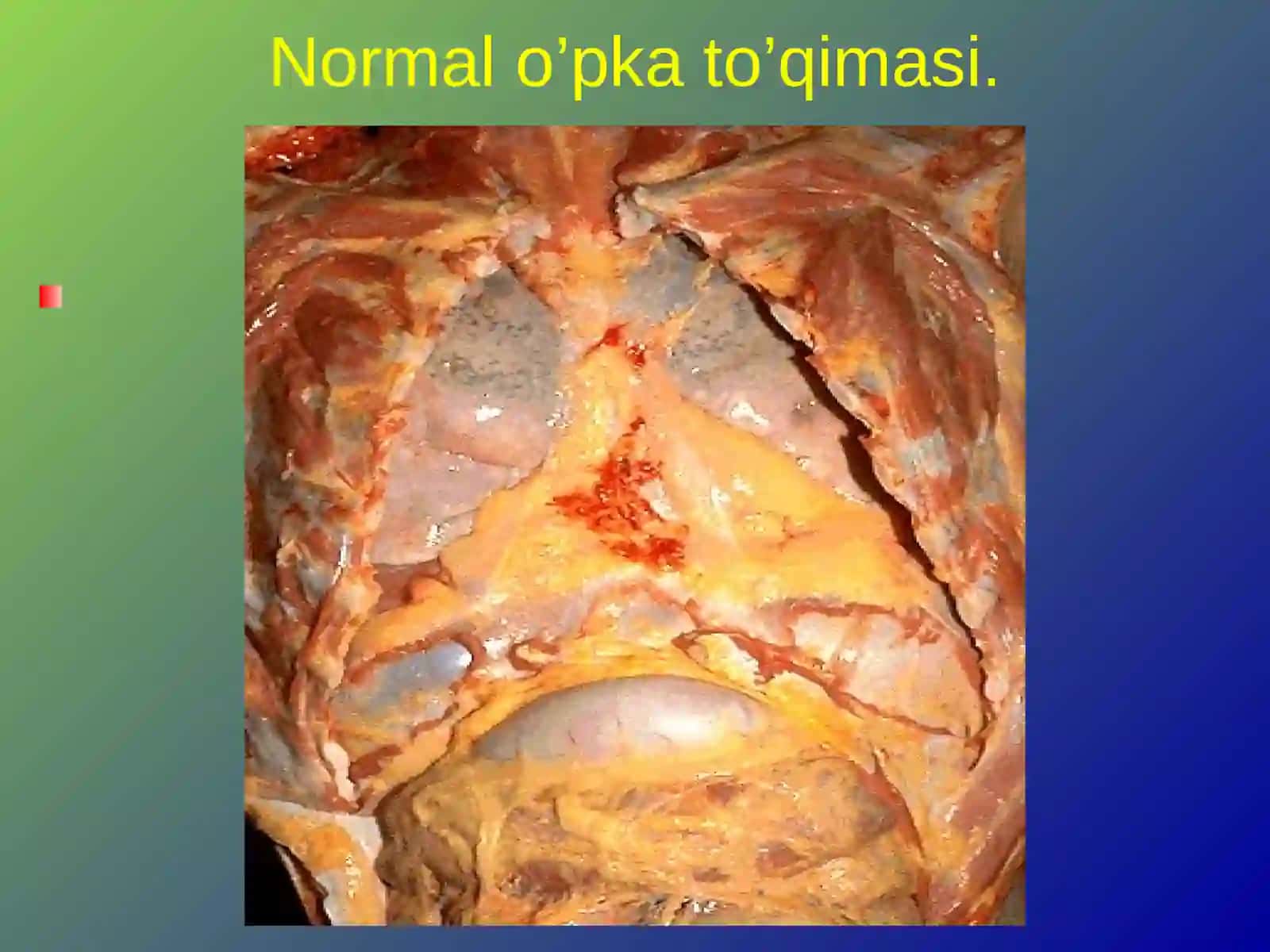 stomatit patologiyasi 3