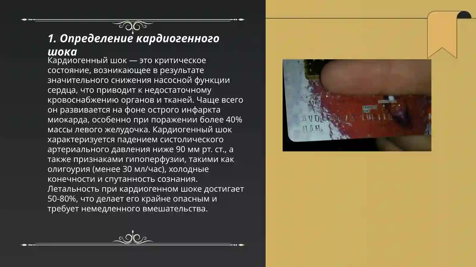 Кардиоген шоква 3