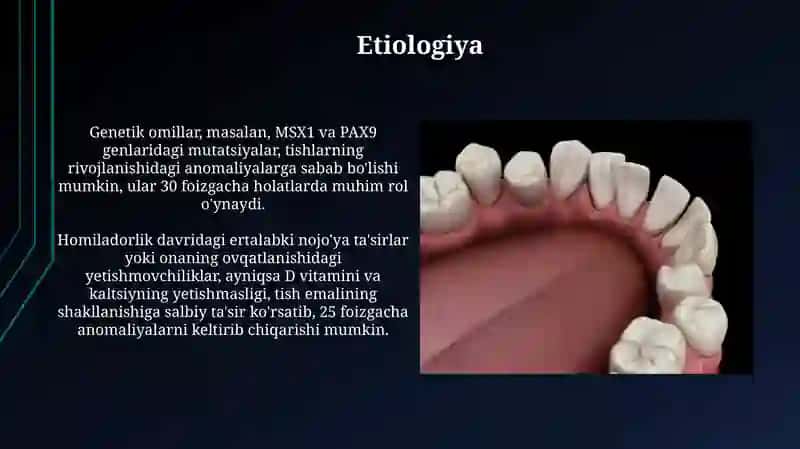 Tishlash va tishlarning rivojlanishida uchraydigan anomaliyalar 3