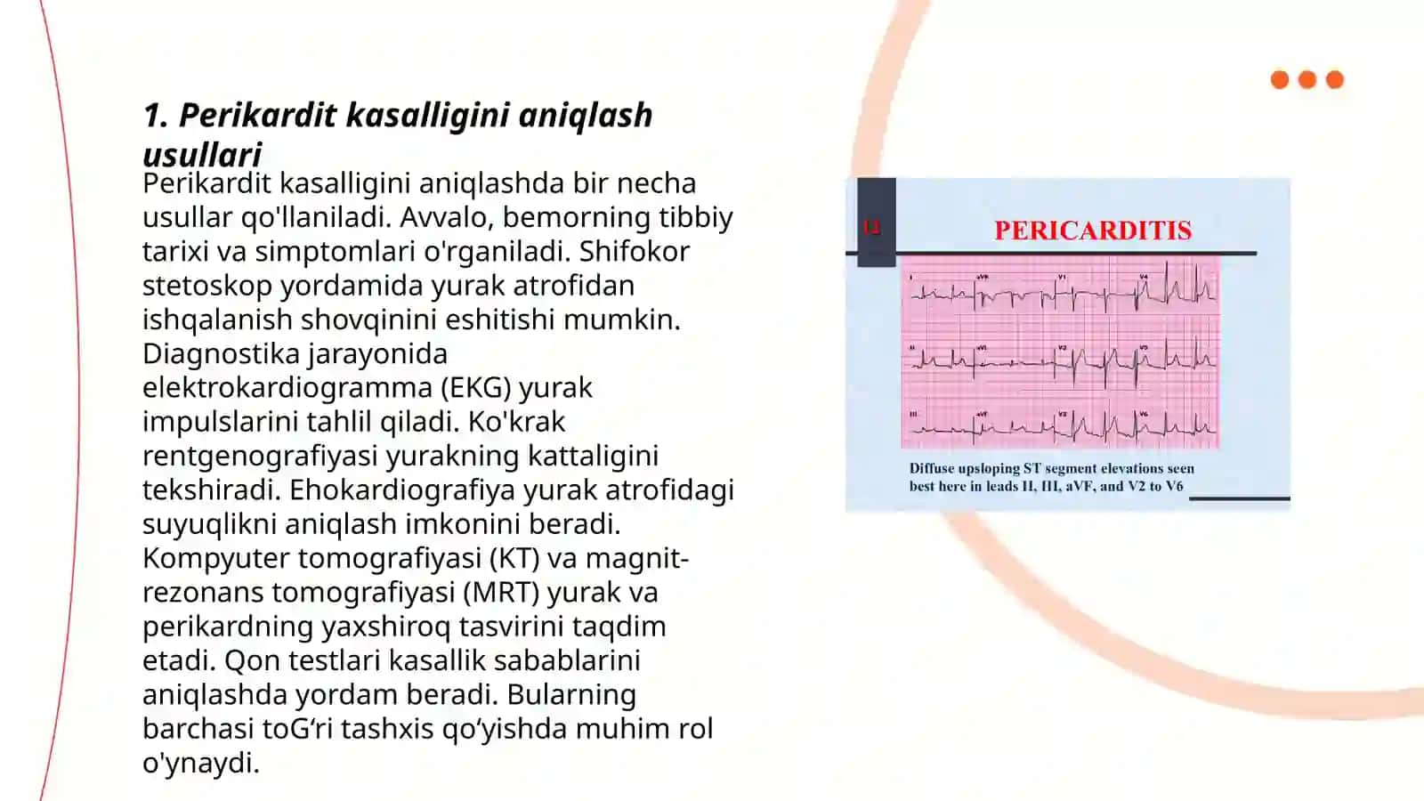 Perikardit kassaligi 3
