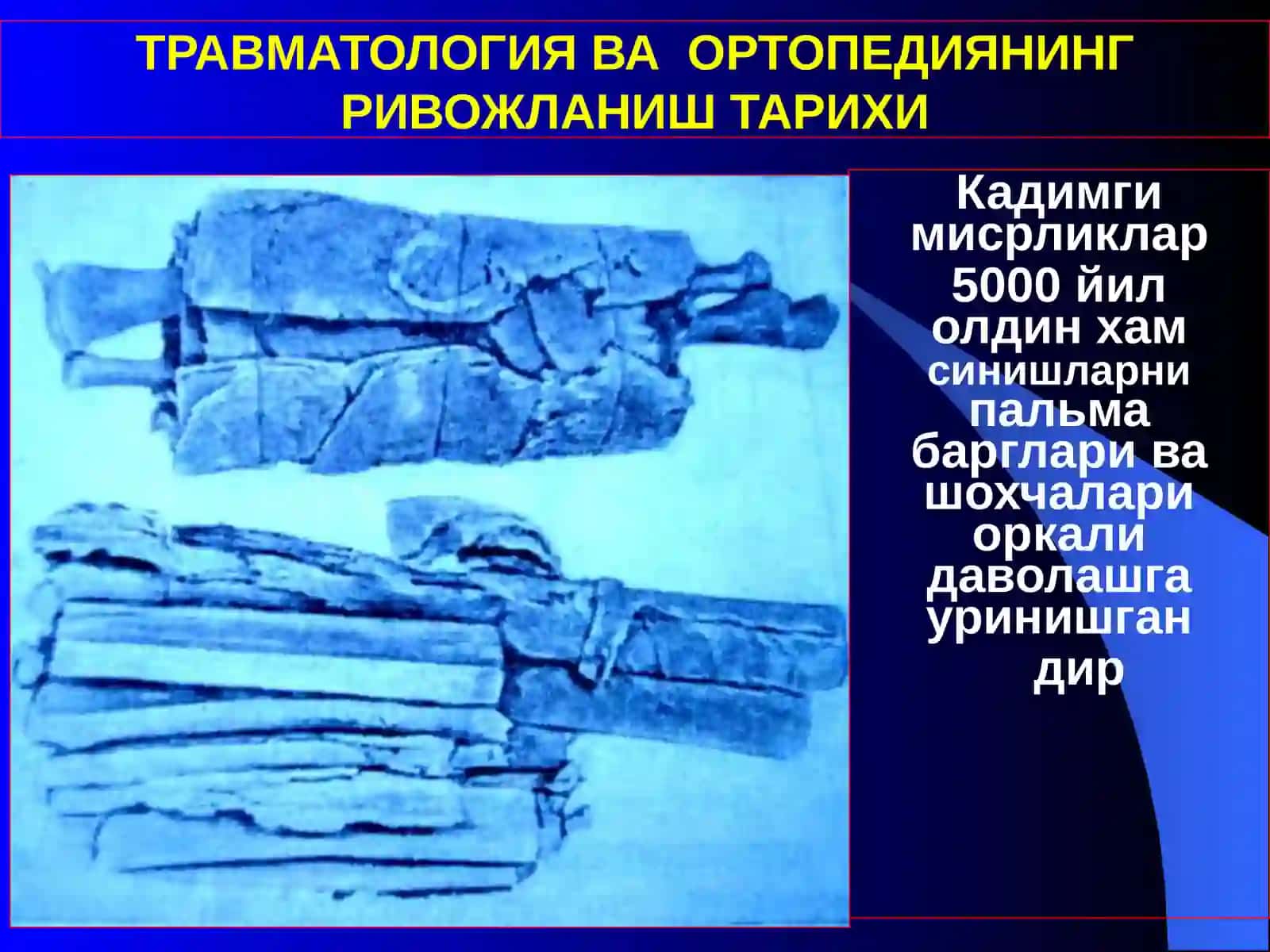 Травматология-Ортопедия 3