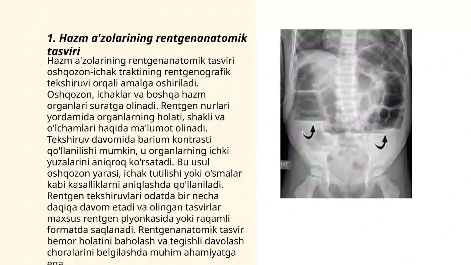 Hazm aʼzolarining rentgenanatomiyasi va rivojlanish nuqsonlari 3