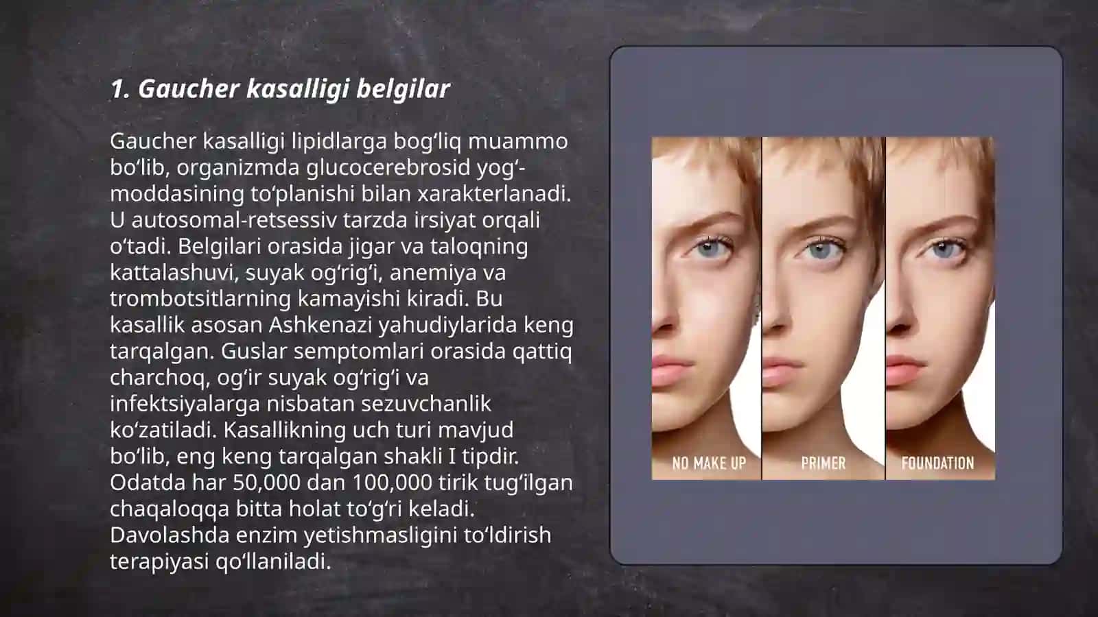 Sistemali lipidozlar goshe tey saks niman pak kasalliklari 3