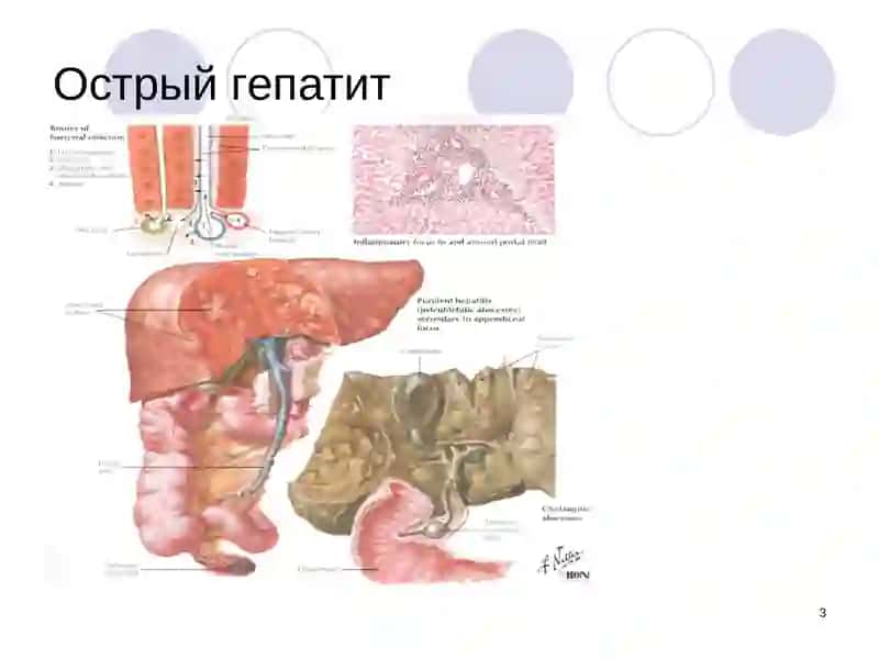 Болезни печени, желчевыводящих путей и поджелудочной железы 3
