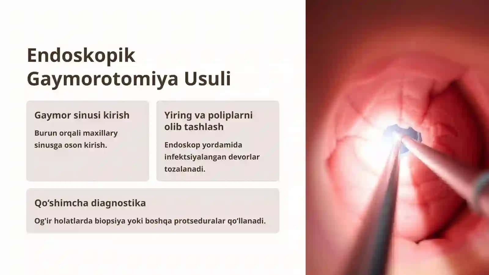 Peshona va Yuqori Jag Boshliqlarini Ochish Texnikasi: Endoskopik Fronto va Gaymorotomiya Usullari 3