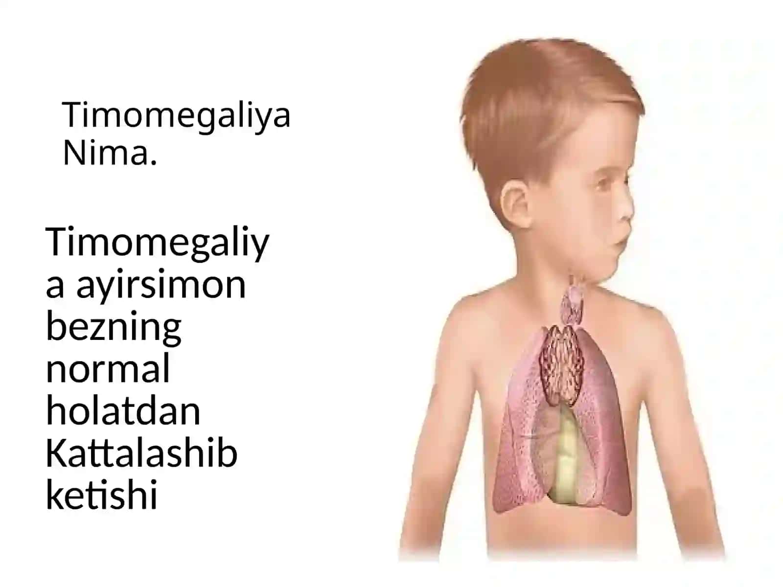 Timomegaliya 3