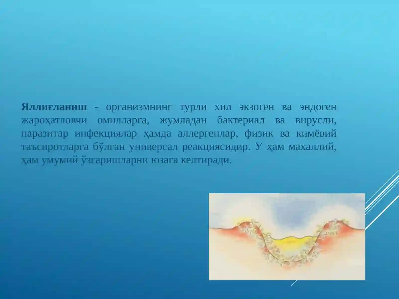 Стероид ва ностероид яллиғланишга қарши дори воситалари 3