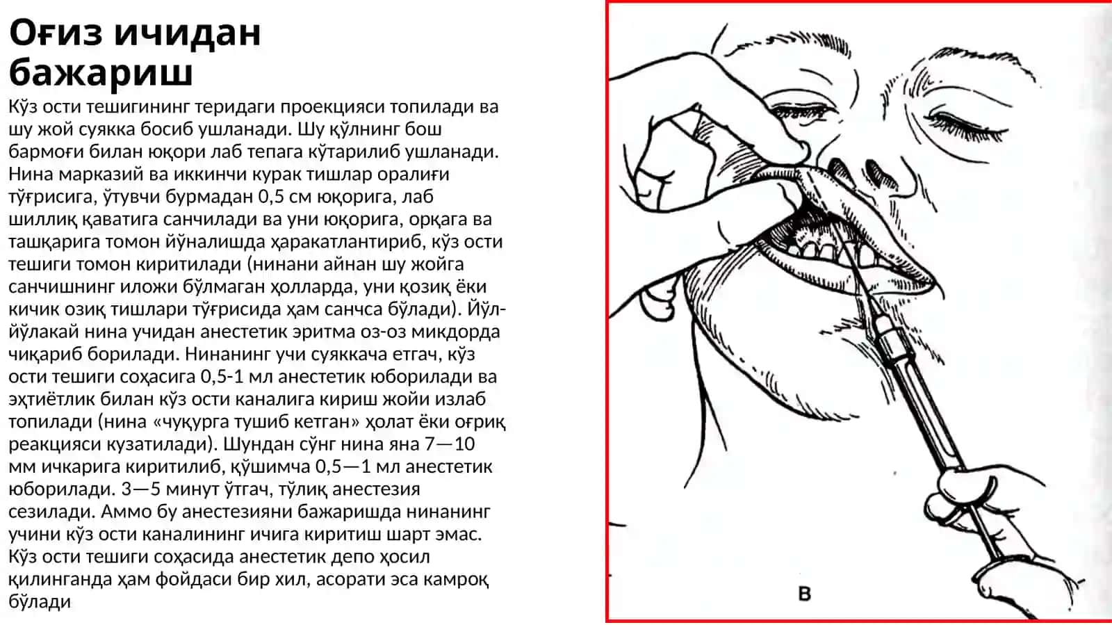 stomatologiyada og‘riqsizlantirishlar. infraorbital, insizival, palatinal. 3