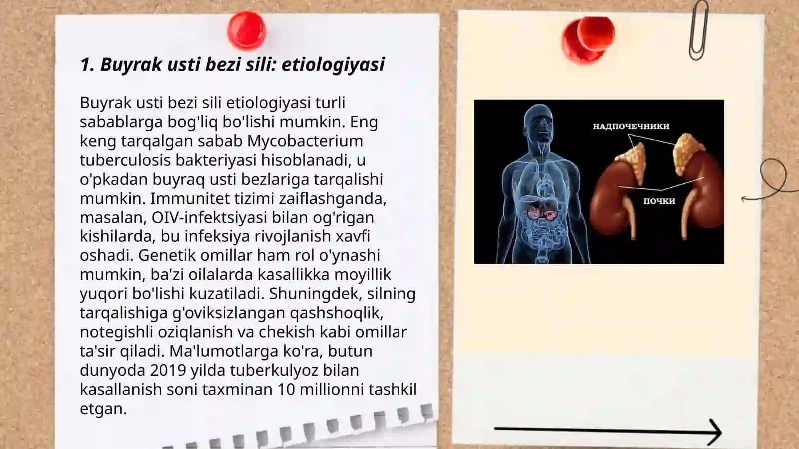 Buyrak usti bezi sili: etiologiyasi 3