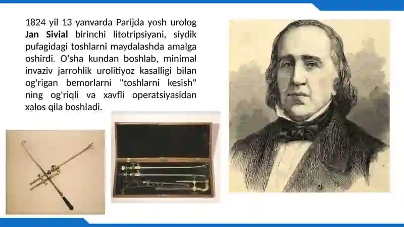 LitotripsiyaApparatlari 3