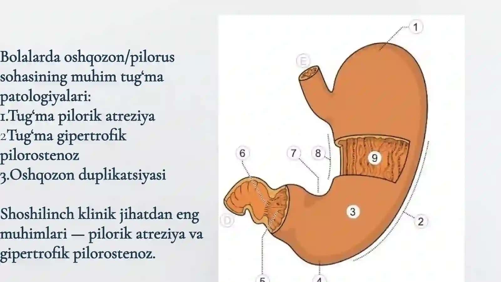 Bolalarda oshqozonning tug‘ma nuqsonlarida shoshilinch tibbiy yordam 3