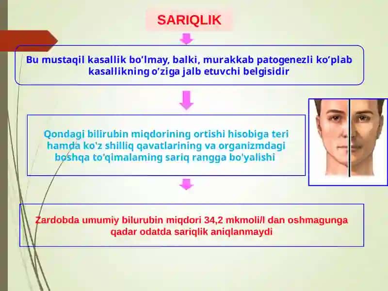 Sariqliklar 3