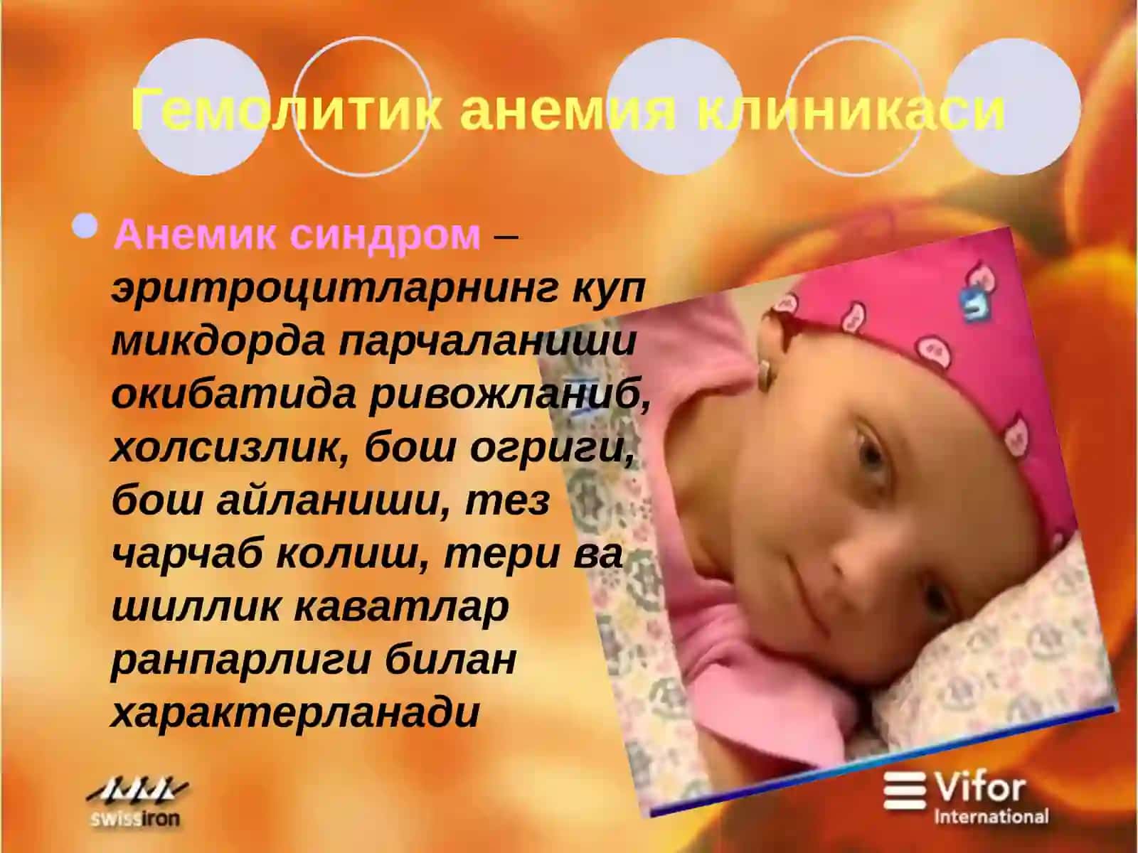 Гемолитик анемия 3