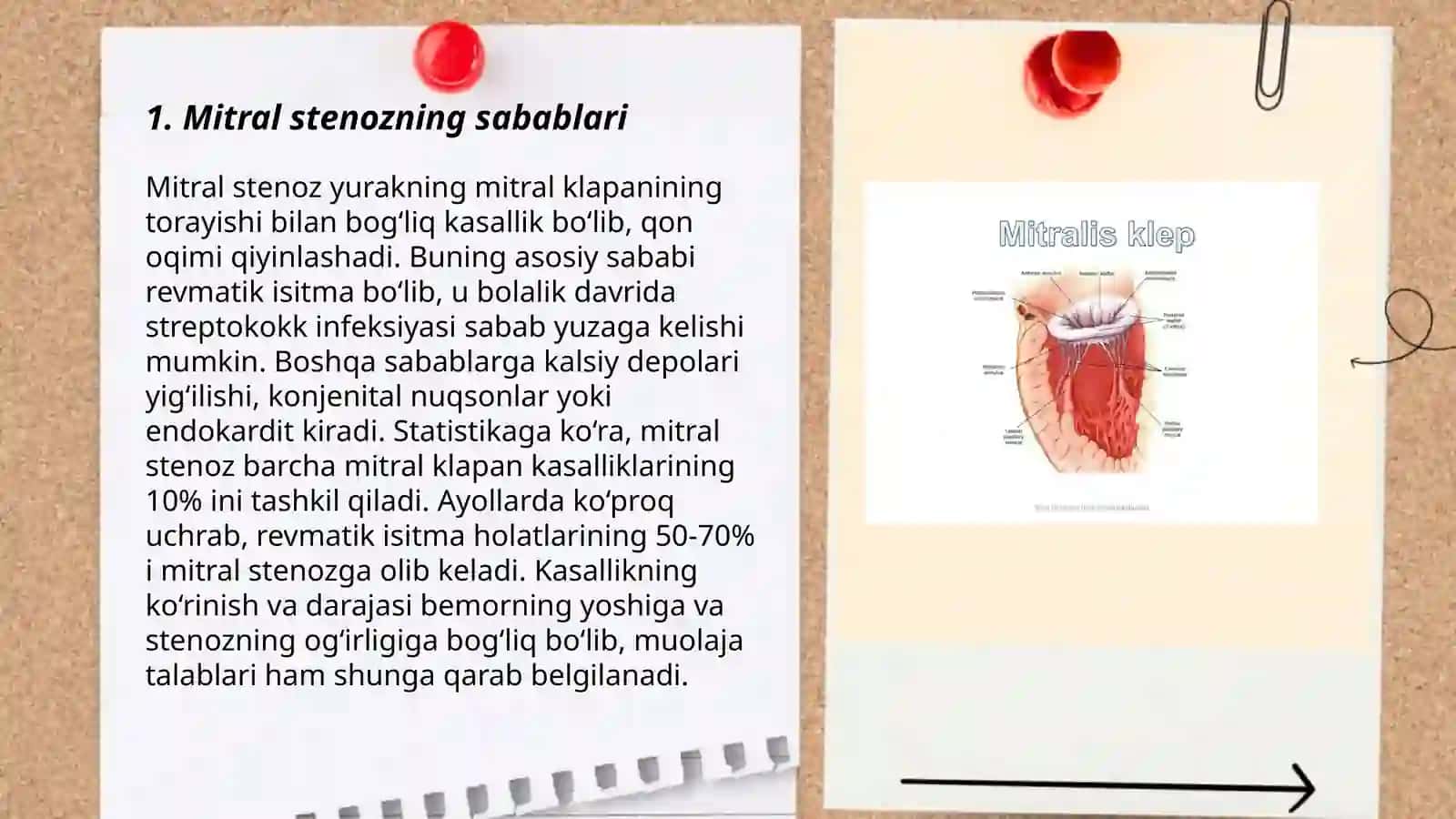 Mitral stenoz 3