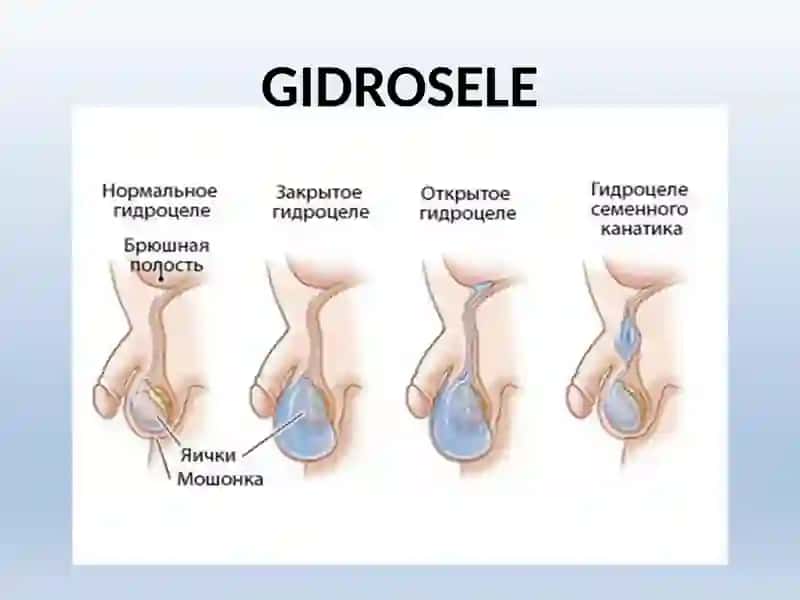 ERKAKLAR TANOSIL A`ZOLARI.AYOLLAR TANOSIL A`ZOLARI 3