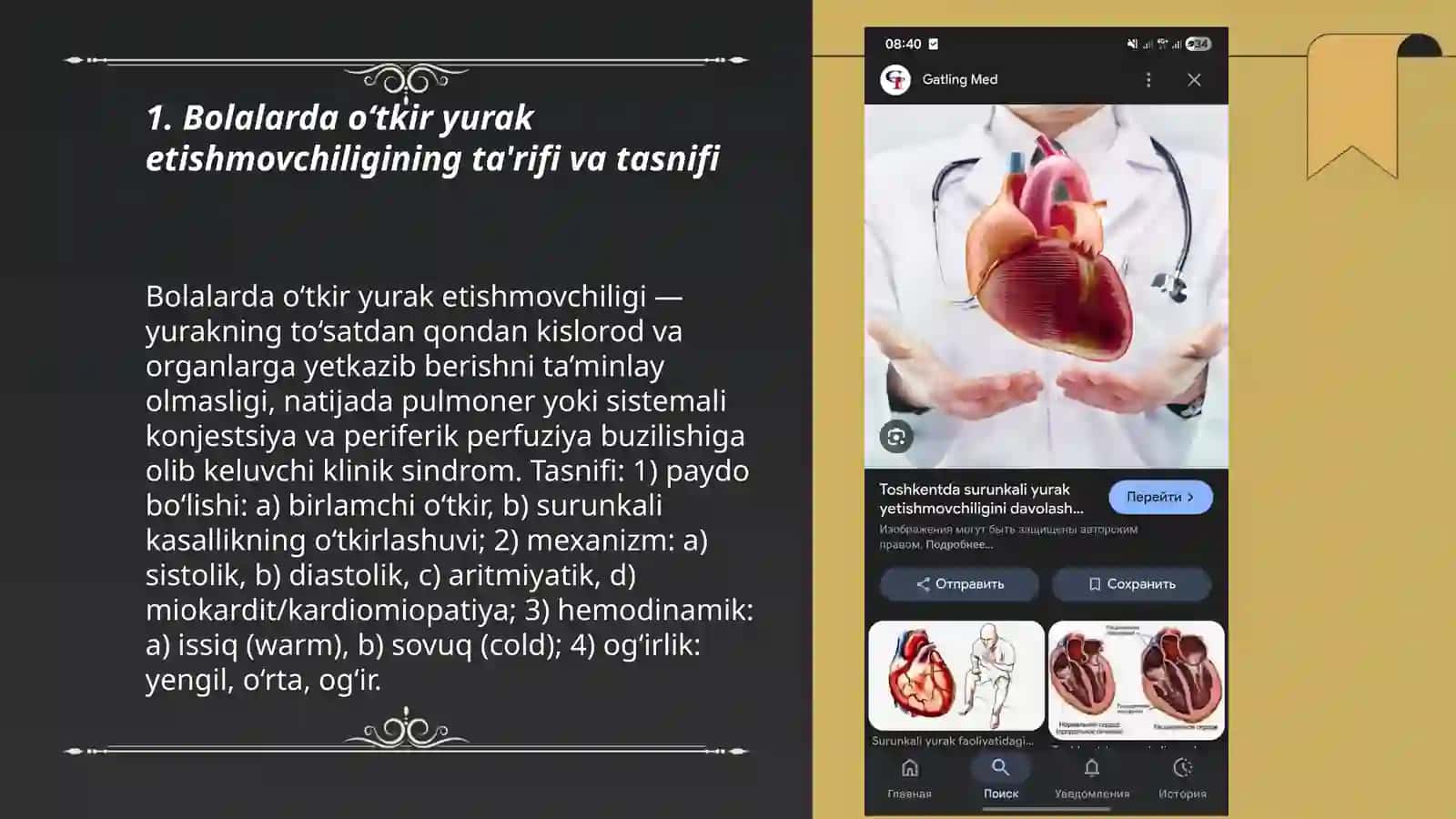 Bolalarda o‘tkir yurak etishmovchiligi 3