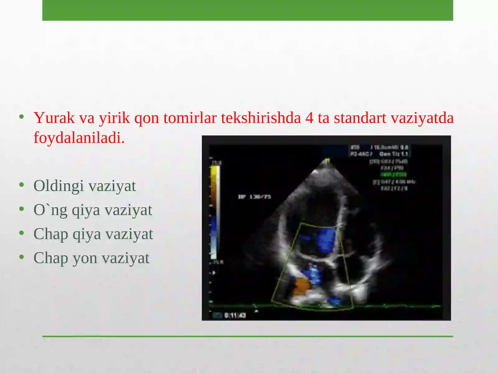 Yurak va yirik qon tomirlar kasalliklarining kompleks nur diagnostikasi 3