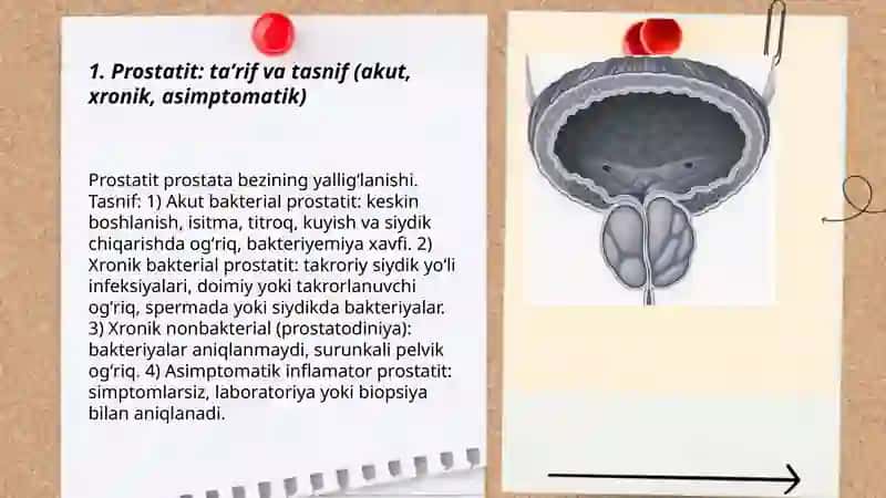 Prostatit va uretrit 3
