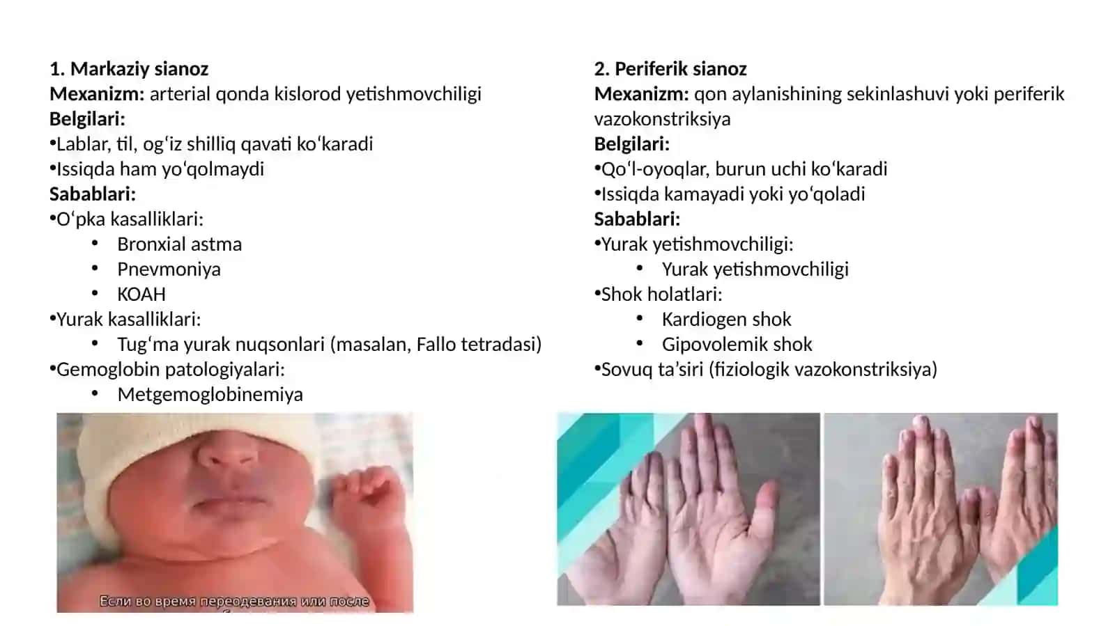 Sianoz bo'yicha differensial diagnostika 3