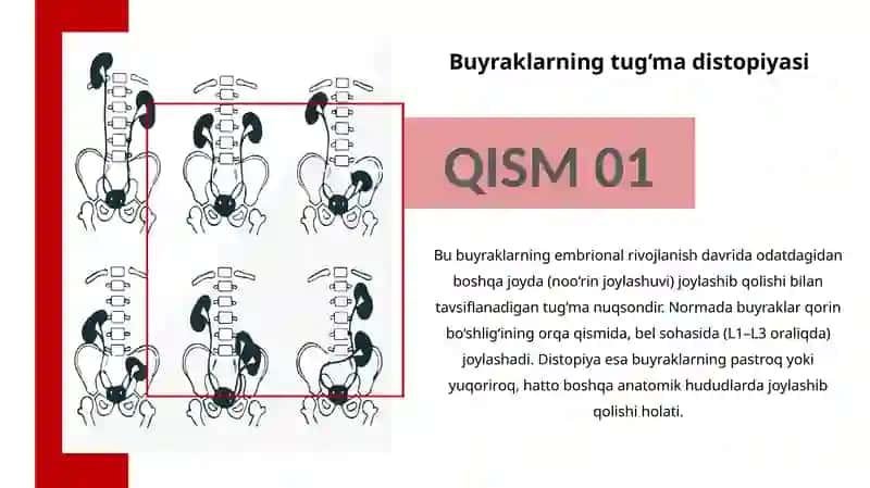 Buyraklarning tug'madi stopiyasi 3