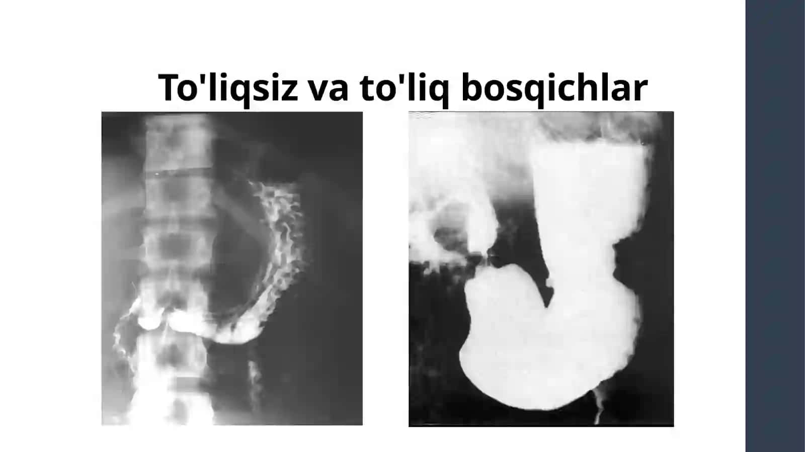 Oshqozon-ichak trakti nur diagnostikasi 3