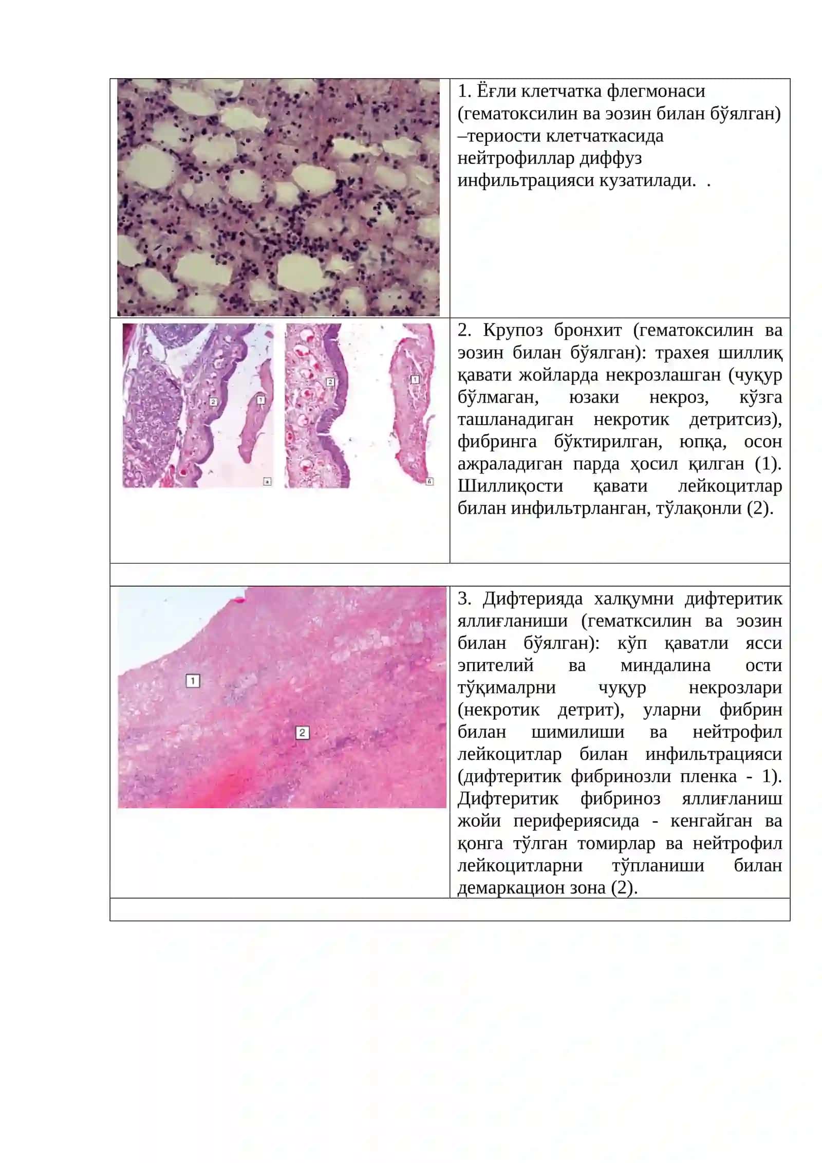 Йирингли инфекциялар ва сепсис 3