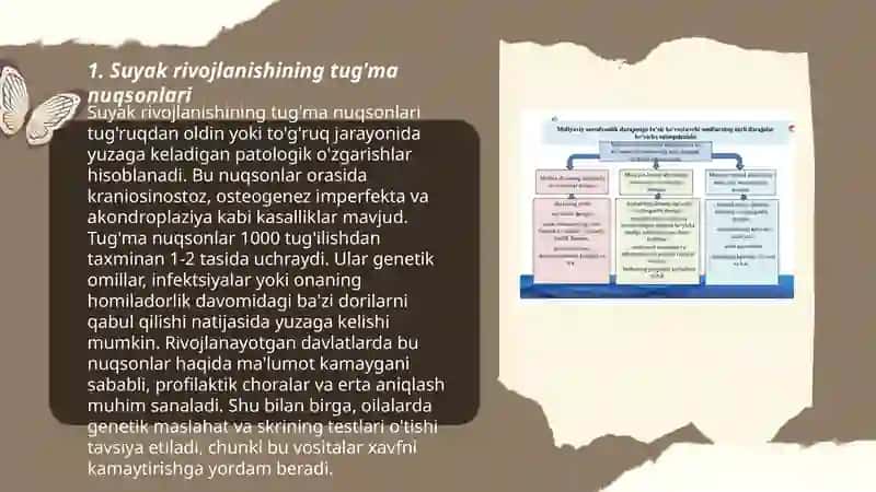 Suyakning rivojlanish anamaliyalari 3