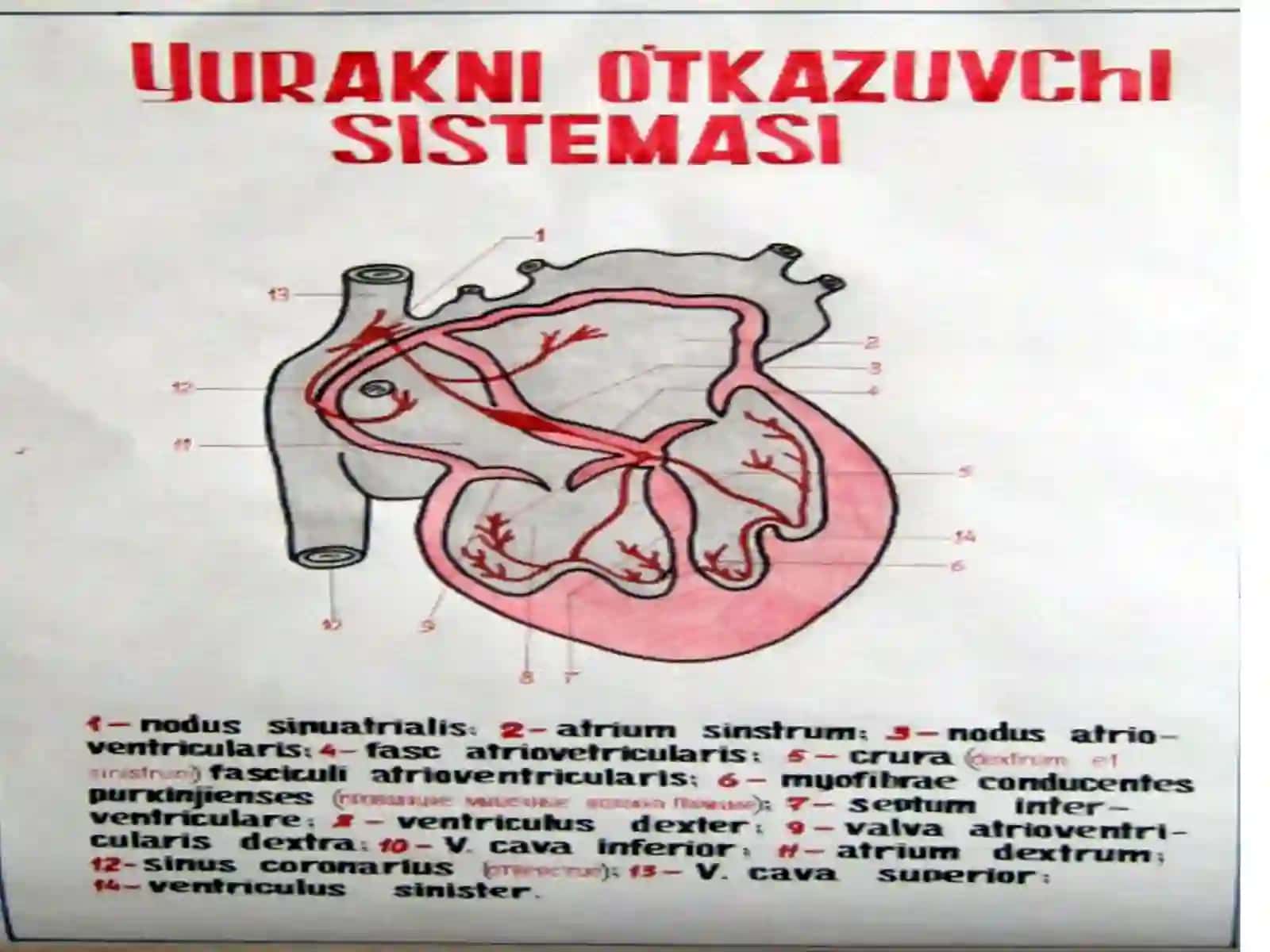 АРИТМИЯ 3