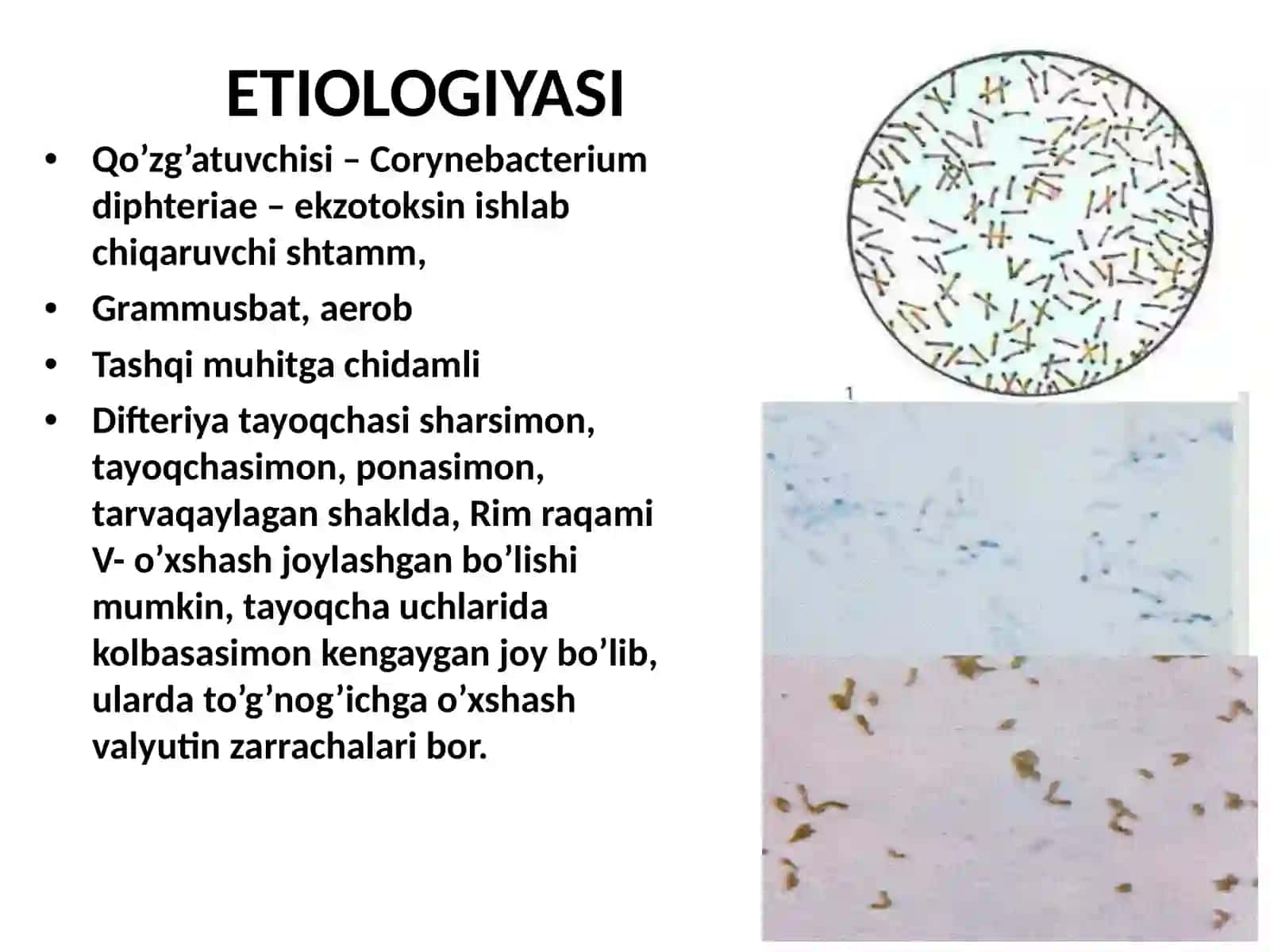 BOLALAR INFEKSIYASI. BO'G'MA. SKARLATINA. QIZAMIQ PATOMORFOLOGIYASI 3