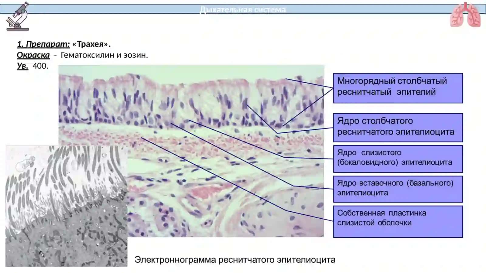 Трахея 3