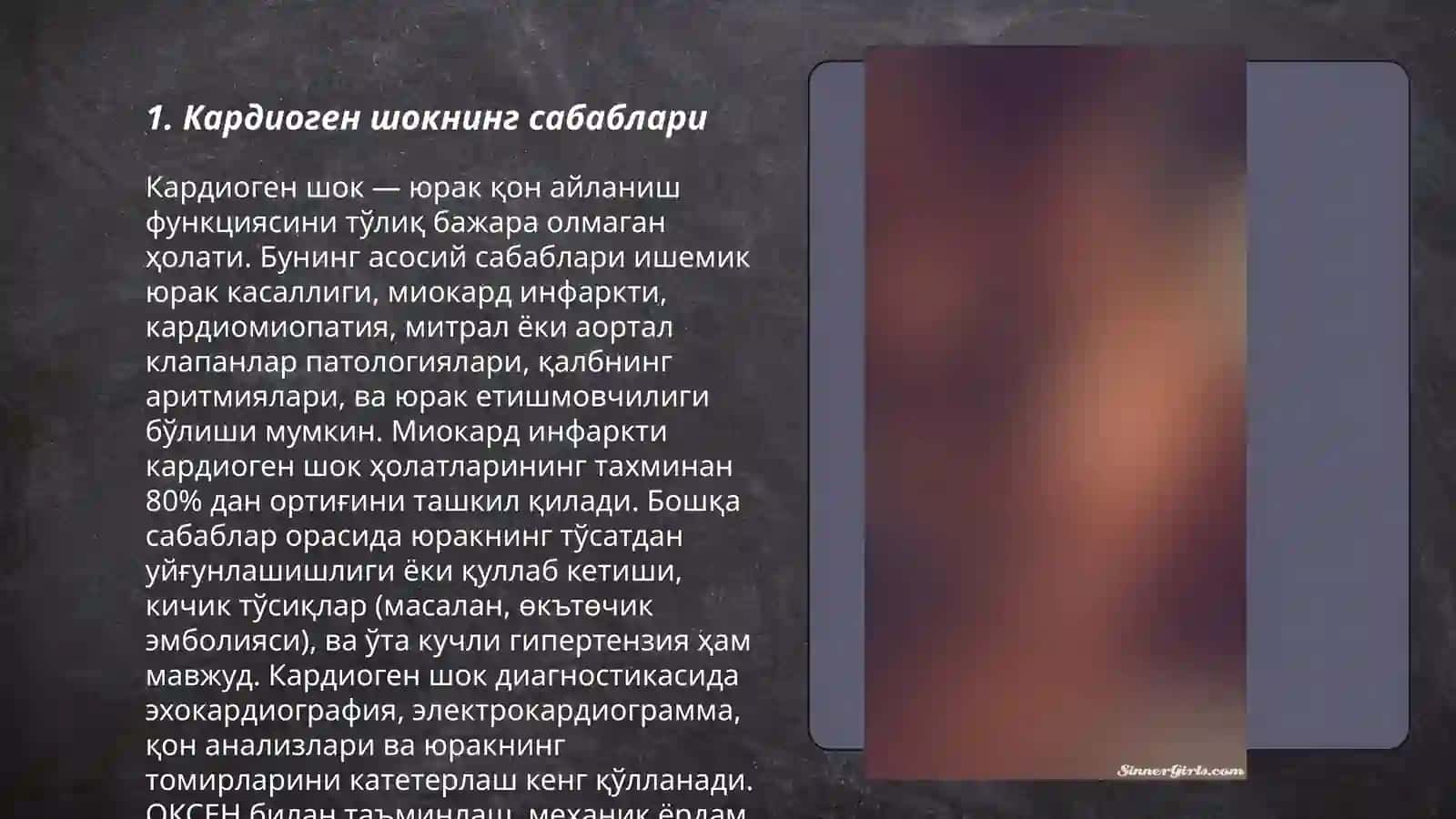 Кардиоген шок 3