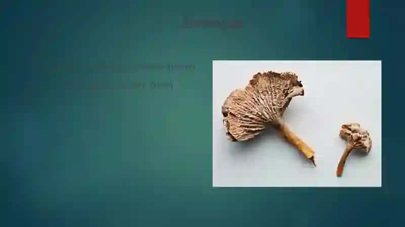 Osteomiyelit 3