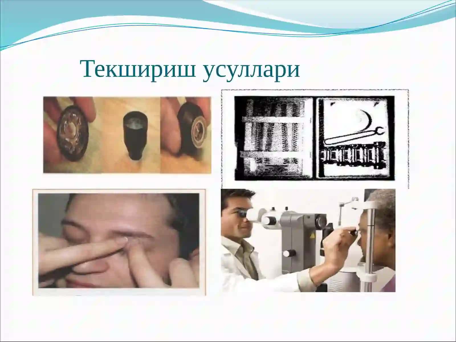 Глаукома 3