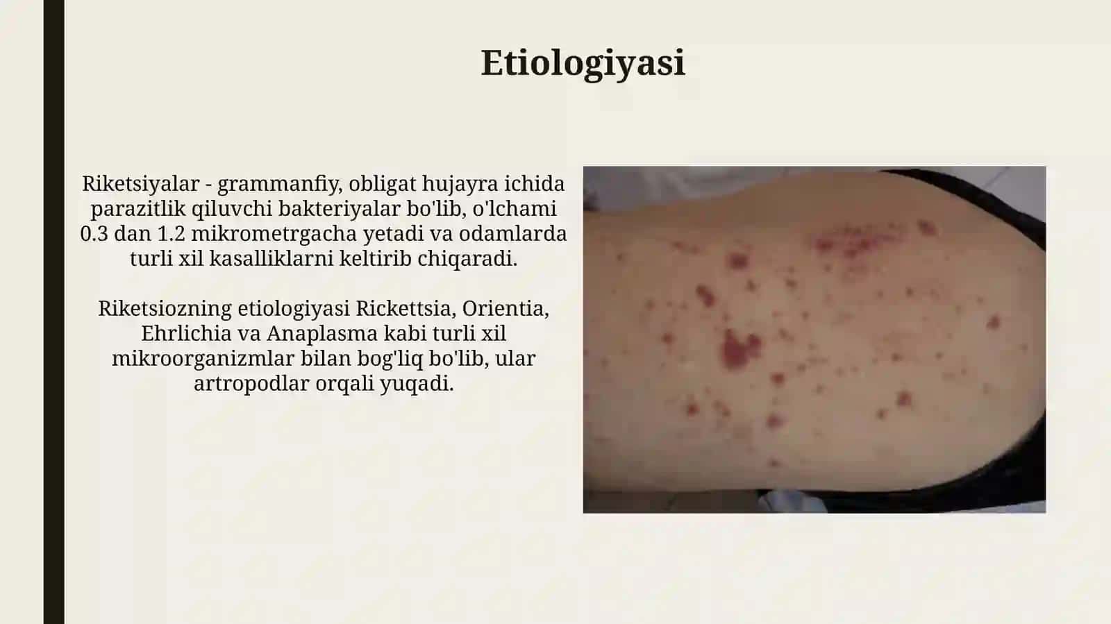 Rikketsiozlar. Etiologiyasi, epidemiologiyasi, klinikasivadavolash 3