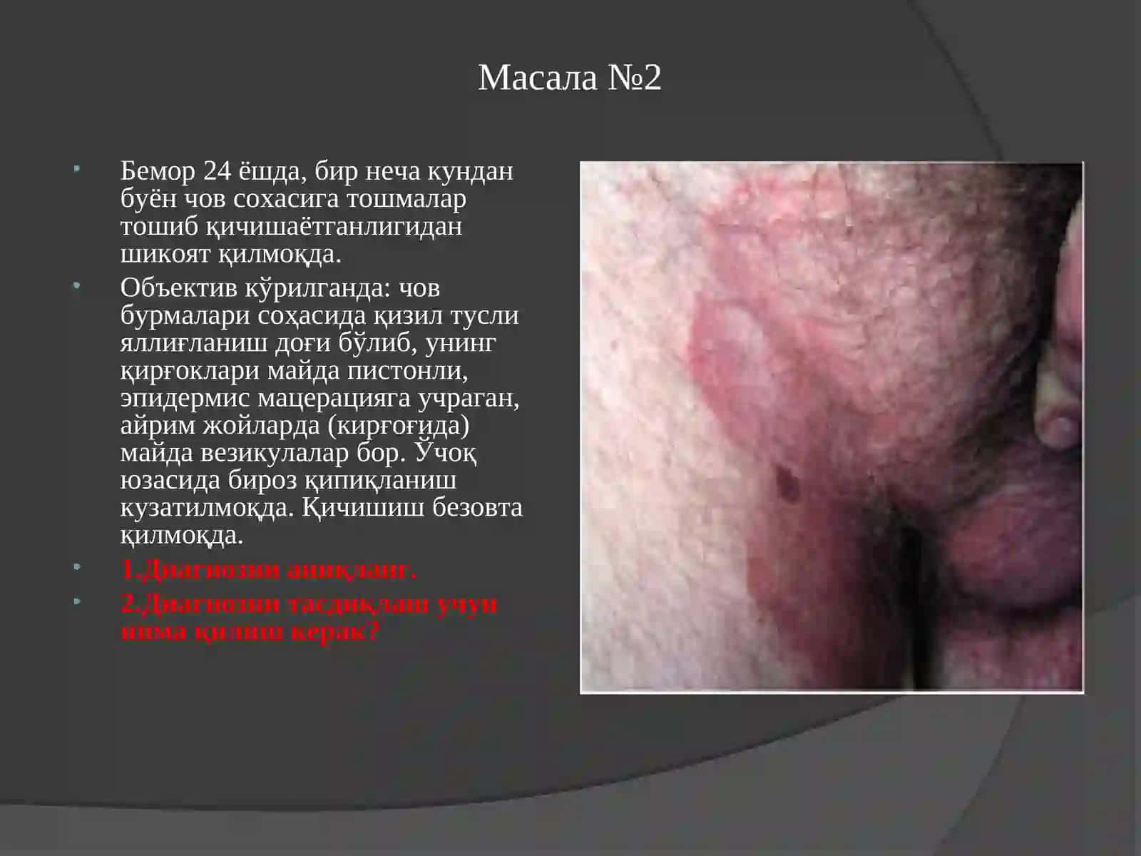 Масала №1 3