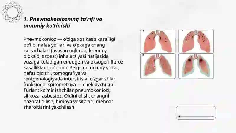 Pnevmokonioz 3