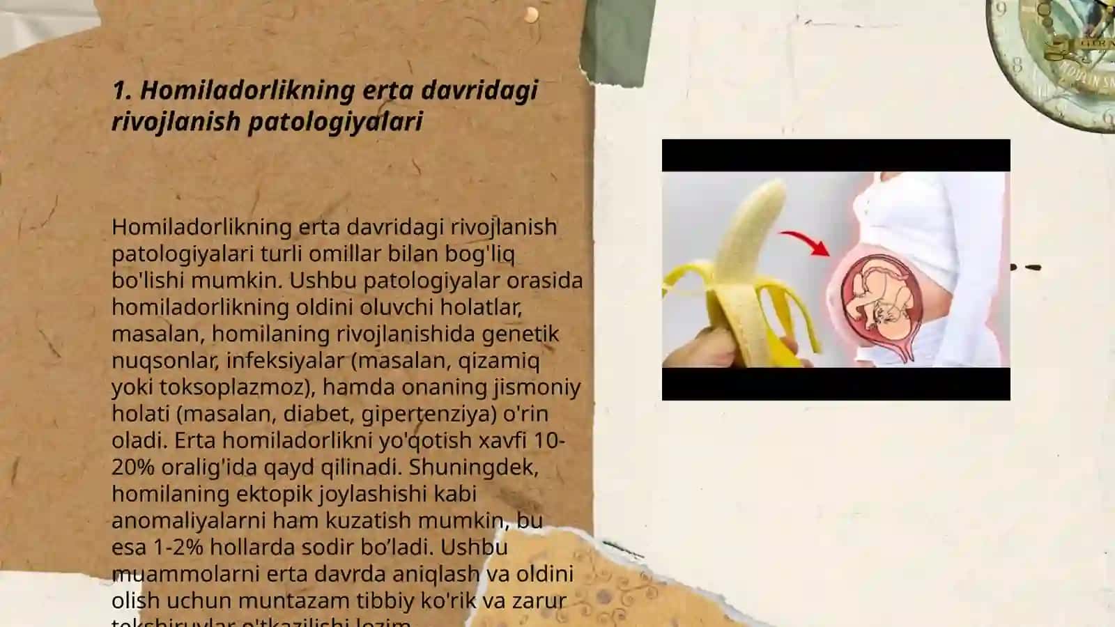Ona qornida rivojlanish patalogiyasi 3