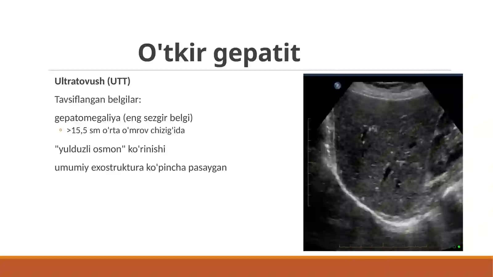 Gepatobiliar tizim nur diagnostikasi 3