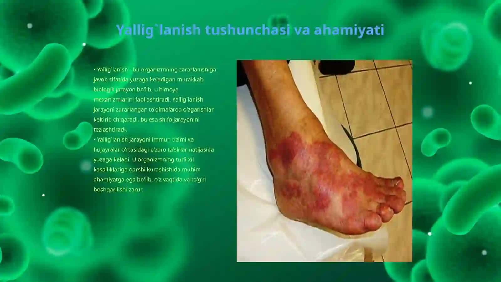 Yallig`lanishning umumiy klinik korinishlari.O`tkir faza javobi,etiologiyasi va patogenezi haqida tushuncha 3